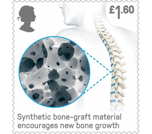 Synthetic Bone Graft - United Kingdom 2019 - 1.60