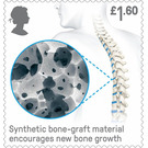 Synthetic Bone Graft - United Kingdom 2019 - 1.60