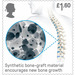 Synthetic Bone Graft - United Kingdom 2019 - 1.60